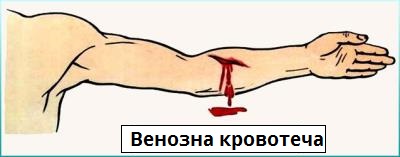 Реферат: Кровотечі Види кровотеч Перша допомога при кровотечах