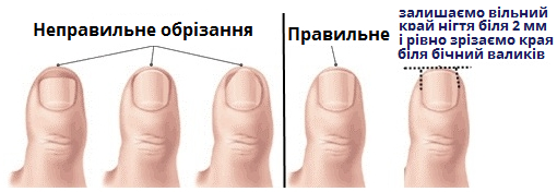 обріззання нігтів.png
